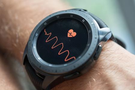 Auch Smartwatches und Wearables können dabei helfen, Herzrhythmusstörungen auf die Spur zu kommen. 