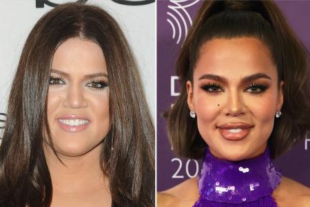 Khloé Kardashian packt über alle Beauty-Eingriffe aus Khloé Kardashian packt über alle Beauty-Eingriffe aus