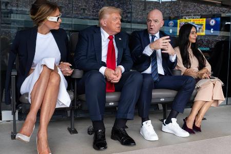 Dicke Knöchel und blaue Flecken: Daran leidet Donald Trump