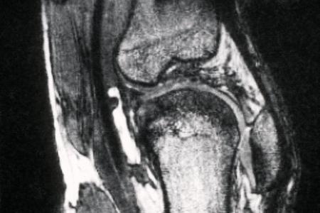 Schmerzen im Knie treiben viele Versicherte zum Orthopäden - viele kommen dort mit fragwürdigen Therapien in Kontakt. (Archivbild)
