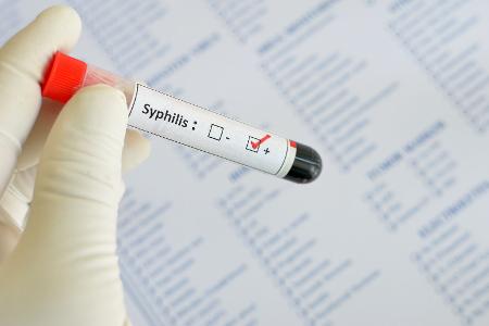 Syphilis-Rekordwert in Deutschland
