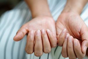 Brüchige Nägel? So stärkt man sie langfristig