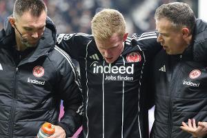 Toppmöller nach Burkardt-Ausfall: "Genug Optionen"