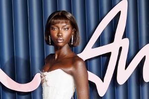 "Model des Jahres" Anok Yai musste sich Lungen-OP unterziehen