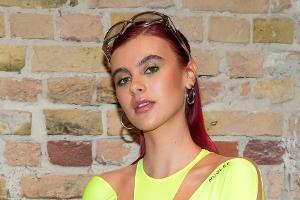 Ex-"GNTM"-Model Romina Palm muss nach Skiunfall operiert werden