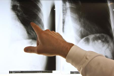 Patientenschützer sind über die geplanten Neuregelungen bei der Ärztewahl besorgt. (Archivbild)