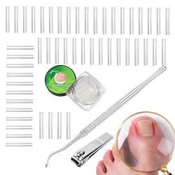 Nagelkorrekturset | C-förmiger Zehennagelknipser Nagelkorrekturwerkzeug - Mit eingewachsenem Zehennagelheber, gebogenem Zehennagelkorrektor für Pediküre-Werkzeug Anulely von Anulely