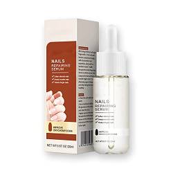 GFOUK 7 Tage Nagelwachstum und Stärkungsserum, Nagelwachstum und Kraftserum, Zehennagelreparatur, Nagelwachstum- und Kraftserum, Nagelreparaturlösung (1 Stück) von Aumude