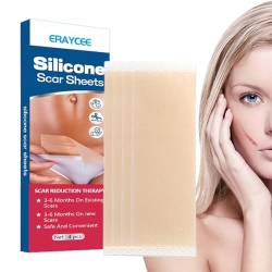 Silikonband für Narben - 4er-Pack effektive wiederverwendbare Silikonfolie,Silikon-Narbenband für chirurgische Narben, Narbenentfernung bei Kaiserschnitt-Bauchstraffung, Keloid und chirurgischen Bittu von BITTU