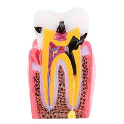 Zahnanatomie-Modell, kompaktes Zahnmodell für die Mundpflege von Fupi