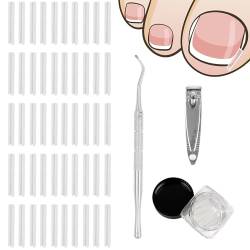 50 Stück Inline-Zehennagelkorrekturstreifen, 1 Stück Nagelknipser + 1 Stück Nagelschere, Zehenkorrektur, Inline-Zehennagelpflaster, für eingewachsene Nägel und Paronychie-Behandlung von MEMOFYND