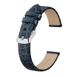 MILNBJK Jeniko Neue Frauen Echtes Leder Uhrenarmbänder 8mm 10mm 12mm 14mm 16mm 18mm 19mm 20mm Ersatz Band Armband Dame Watchban (Color : Blue, Size : 10mm) von MILNBJK