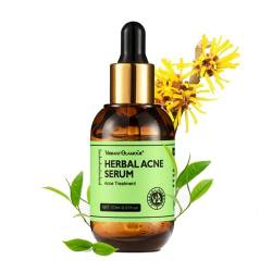 Anti Akne Serum für Gesicht, Natürliche Herbal Gesichtsserum für Verbesserung Pickel, Pore, Akne, Narbe, Anti pickel Serum Gesichtspflege für alle Hauttypen von Akne von Rosarden