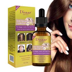 Ingwer-Haaröl | Ätherisches Öl für natürliche Haardichte, 30 ml - Haarwuchsöl für dickeres, volleres und gesünderes Haar, Haaröl für nachwachsendes Haar bei Männern und Frauen Ximan von Ximan