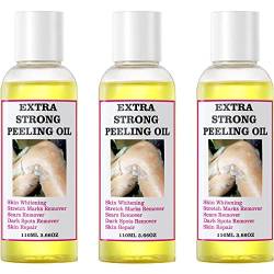 3 x Peeling-Öl für dunkle Haut, extra starkes gelbes Peeling-Öl mit Salicyl-Natrium-Hyaluronat, starkes Aufhellungs-Hautpeeling-Öl, Peeling-Lösung für alle Hauttypen von Ycxydr