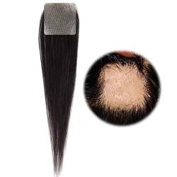 Haarpflaster für den vorderen Haaransatz, Haarpflaster für kahle Stellen, Echthaar-Toupet für Männer/Frauen, zum Abdecken von Haarausfall(1.8 * 1.8cm) von ZBYXPP