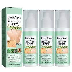 Toxiklenz Back Acne Treatment Spray, 2023 NewBack Acne Treatment Spray, Back Acne Treatment, Acne Spray Back and Chest, Spray for Back Acne, Gentle on Skin (3PCS) von ZQTWJ
