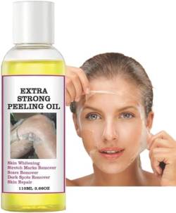 Extra Strength Yellow Peeling Oil, Peeling Oil for Dark Skin, Strong Peeling Oil Extra Strength, Exfoliating Peeling Solution,Body Scrub, Peeling Körper, Gelbes Schäferöl Für Körper alle Haut (1PC) von vokkrv